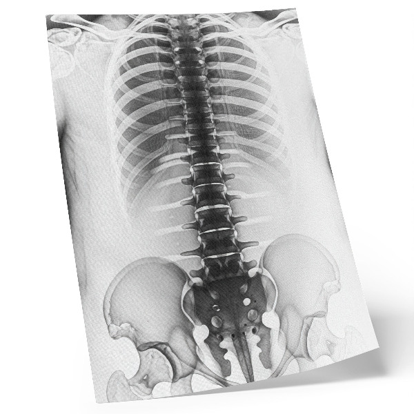 Premium wall art Skeleton in black and white